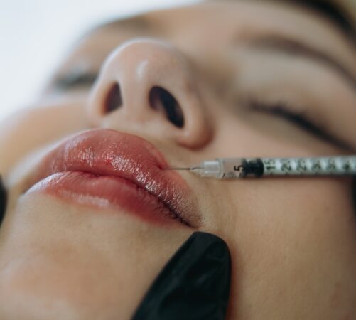 Precision,Lip,Enhancement:,Professional,Injectable,Treatment,In,Progress.,High,Quality