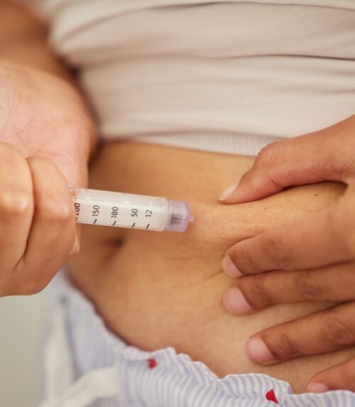 Medical weight loss in Abu Dhabi